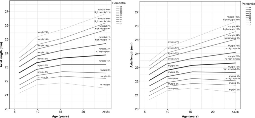 Tideman JWL, Polling JR, Vingerling JR, et al. Axial length growth and the risk of developing myopia in European children. Acta Ophthalmol. 2018;96(3):301–309. doi:10.1111/aos.13603